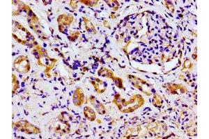 Immunohistochemistry of paraffin-embedded human kidney tissue using ABIN7169068 at dilution of 1:100 (MARK2 antibody  (AA 373-594))