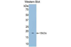 Western Blotting (WB) image for anti-Lectin, Galactoside-Binding, Soluble, 9B (LGALS9B) (AA 228-355) antibody (ABIN1858956) (LGALS9B antibody  (AA 228-355))