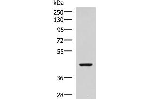 Western blot analysis of SP20 cell lysate using ISL2 Polyclonal Antibody at dilution of 1:800 (ISL2 antibody)