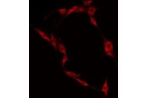 ABIN6274950 staining HepG2 by IF/ICC. (CLIP4 antibody  (Internal Region))