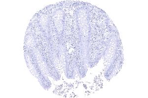 Complete absence of papp A immunostaining in epithelial and stromal cells of the appendix mucosa (PAPPA antibody  (AA 351-523))
