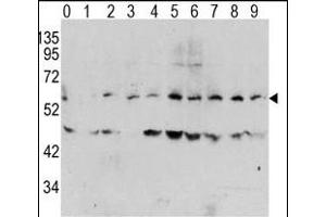 Western blot analysis of Phospho-MYC-T58 Antibody in human T activated Hela cell line lysates.