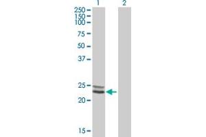 Western Blot analysis of NDUFV2 expression in transfected 293T cell line by NDUFV2 MaxPab polyclonal antibody.