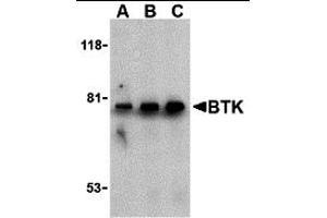 Western Blotting (WB) image for anti-Bruton Agammaglobulinemia tyrosine Kinase (BTK) (N-Term) antibody (ABIN1031284) (BTK antibody  (N-Term))