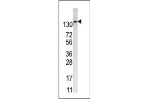 Western blot analysis of anti-PFKFB2 Pab (ABIN392769 and ABIN2842214) in mouse kidney tissue lysate (35 μg/lane). (PFKFB2 antibody  (N-Term))