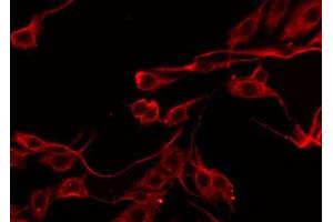 Immunofluorescence (fixed cells) (IF/ICC) image for anti-serpin Peptidase Inhibitor, Clade B (Ovalbumin), Member 5 (SERPINB5) (Internal Region) antibody (ABIN6265008)