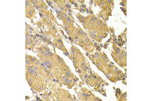 Immunohistochemistry of paraffin-embedded human stomach using PPP2CA antibody at dilution of 1:100 (x400 lens). (PPP2CA antibody)