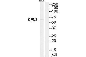 Western Blotting (WB) image for anti-Carboxypeptidase N Subunit 2 (CPN2) (C-Term) antibody (ABIN1851028) (CPN2 antibody  (C-Term))