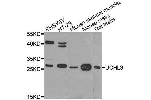 Western blot analysis of extracts of various cell lines, using UCHL3 antibody. (UCHL3 antibody  (AA 1-220))