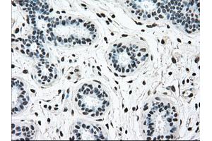 Immunohistochemical staining of paraffin-embedded breast tissue using anti-BRAF mouse monoclonal antibody. (BRAF antibody)