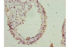 Immunohistochemistry of paraffin-embedded human testis tissue using ABIN7154313 at dilution of 1:100 (GOSR2 antibody  (AA 1-190))
