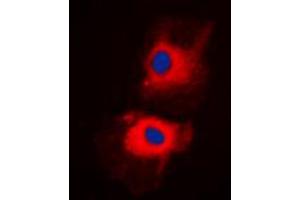 Immunofluorescent analysis of HGS staining in H1299 cells. (HGS antibody  (Center))