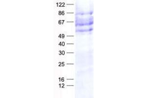 Validation with Western Blot
