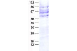 Validation with Western Blot (CREB3L1 Protein (His tag))
