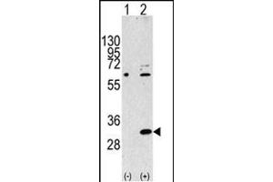 Western Blotting (WB) image for anti-Eukaryotic Translation Initiation Factor 4E Family Member 2 (EIF4E2) (AA 12-41), (N-Term) antibody (ABIN388676)