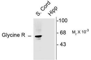 Image no. 1 for anti-Glycine Receptor, alpha 1 (GLRA1) (N-Term) antibody (ABIN372657) (GLRA1 antibody  (N-Term))
