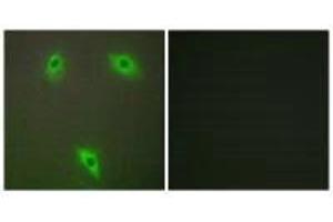 Immunofluorescence analysis of A549 cells, using KLHL3 antibody. (KLHL3 antibody  (N-Term))