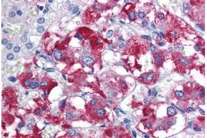 Human Adrenal: Formalin-Fixed, Paraffin-Embedded (FFPE) (Parkin antibody  (AA 311-360))