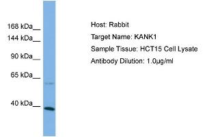 Host: Rabbit Target Name: KANK1 Sample Type: HCT15 Whole Cell lysates Antibody Dilution: 1. (ANKRD15 antibody  (C-Term))