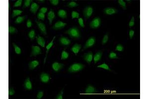 Image no. 3 for anti-Zinc Fingers and Homeoboxes 2 (ZHX2) (AA 691-789) antibody (ABIN599184) (ZHX2 antibody  (AA 691-789))