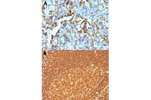 Immunohistochemical staining (Formalin-fixed paraffin-embedded sections) of human histiocytoma (A) and human tonsil (B) with HLA-DRB1 monoclonal antibody, clone HLA-DRB/1067 . (HLA-DRB1 antibody)