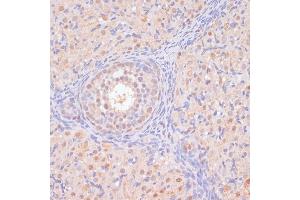 Immunohistochemistry of paraffin-embedded rat ovary using BYSL antibody (ABIN6129546, ABIN6137672, ABIN6137674 and ABIN6215553) at dilution of 1:100 (40x lens). (Bystin-Like antibody  (AA 120-280))