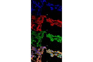 Immunocytochemistry/Immunofluorescence analysis using Mouse Anti-7-Ketocholesterol Monoclonal Antibody, Clone 7E1 . (7-Ketocholesterol (7-KC) antibody (APC))