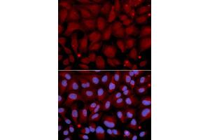 Immunofluorescence analysis of U2OS cell using BCHE antibody. (Butyrylcholinesterase antibody  (AA 29-270))
