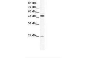 Image no. 1 for anti-Tumor Necrosis Factor Receptor Superfamily, Member 11b (TNFRSF11B) (N-Term) antibody (ABIN202431) (Osteoprotegerin antibody  (N-Term))