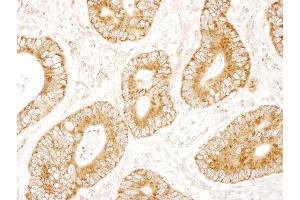 Immunohistochemistry (IHC) image for anti-MAP-Kinase Activating Death Domain (MADD) (AA 1597-1647) antibody (ABIN7448984)
