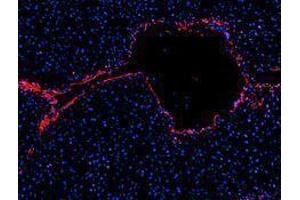 Immunofluorescence (IF) image for anti-Platelet/endothelial Cell Adhesion Molecule (PECAM1) antibody (Alexa Fluor 594) (ABIN2656826) (CD31 antibody  (Alexa Fluor 594))