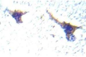 Immunohistochemistry (IHC) analyzes of PKD1/PKC-mu antibody in paraffin-embedded human brain tissue. (PKC mu antibody)