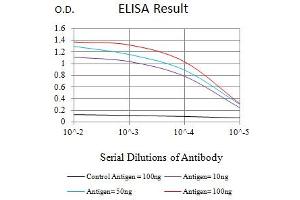 Black line: Control Antigen (100 ng),Purple line: Antigen (10 ng), Blue line: Antigen (50 ng), Red line:Antigen (100 ng) (ZAP70 antibody  (AA 169-390))