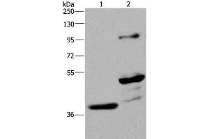 Western Blot analysis of Human fetal brain and Mouse brain tissue using GAS7 Polyclonal Antibody at dilution of 1:625 (GAS7 antibody)