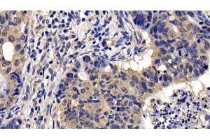 Immunohistochemistry (IHC) image for anti-B Lymphoid Tyrosine Kinase (BLK) (AA 241-494) antibody (ABIN7441157)