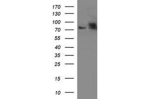 Western Blotting (WB) image for anti-Hydroxysteroid (17-Beta) Dehydrogenase 4 (HSD17B4) antibody (ABIN2715563) (HSD17B4 antibody)