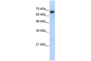 WB Suggested Anti-ZSCAN12 Antibody Titration:  0.