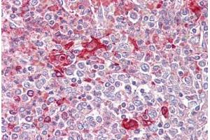 Anti-TLR5 antibody IHC staining of human spleen. (TLR5 antibody  (AA 300-350))