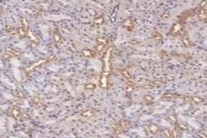 Immunohistochemistry analysis of paraffin-embedded rat kidney using,PFDN4 (ABIN7075171) at dilution of 1: 4200