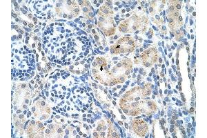 SPPL2B antibody was used for immunohistochemistry at a concentration of 4-8 ug/ml to stain Epithelial cells of renal tubule (arrows) in Human Kidney. (SPPL2B antibody  (N-Term))