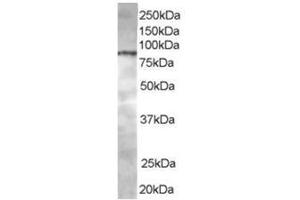 Image no. 1 for anti-ArfGAP with Coiled-Coil, Ankyrin Repeat and PH Domains 1 (ACAP1) (C-Term) antibody (ABIN374366) (ACAP1 antibody  (C-Term))