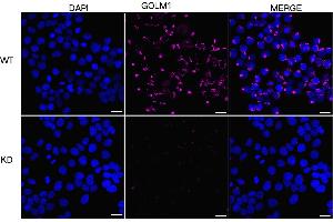 anti-Golgi Membrane Protein 1 (GOLM1) antibody