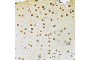 Immunohistochemistry (Paraffin-embedded Sections) (IHC (p)) image for anti-Acidic (Leucine-Rich) Nuclear phosphoprotein 32 Family, Member A (ANP32A) (AA 1-170) antibody (ABIN6136909)