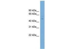 Image no. 1 for anti-Forkhead Box C2 (MFH-1, Mesenchyme Forkhead 1) (FOXC2) (AA 51-100) antibody (ABIN6746183) (FOXC2 antibody  (AA 51-100))