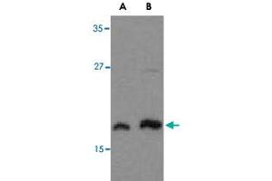Western blot analysis of MLST8 in human brain tissue lysate with MLST8 polyclonal antibody  at (A) 1 and (B) 2 ug/mL . (GBL antibody  (C-Term))