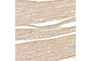 Immunohistochemistry of paraffin-embedded rat heart using SARA Rabbit mAb (ABIN7271559) at dilution of 1:50 (40x lens).
