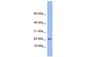 WB Suggested Anti-RPS24  Antibody Titration: 0. (RPS24 antibody  (Middle Region))
