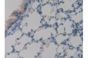 Detection of PLA2R1 in Mouse Lung Tissue using Polyclonal Antibody to Phospholipase A2 Receptor 1 (PLA2R1)