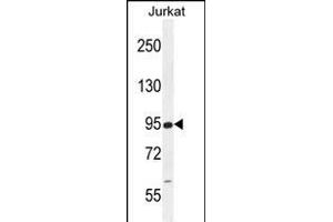 RSBN1 Antibody (N-term) (ABIN655484 and ABIN2845005) western blot analysis in Jurkat cell line lysates (35 μg/lane). (RSBN1 antibody  (N-Term))