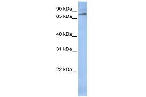 ALOX12 antibody used at 1 ug/ml to detect target protein. (ALOX12 antibody  (C-Term))